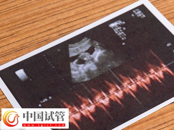 杭州正規促排醫院排名公布，浙江省婦保醫院綜合第一(圖1)