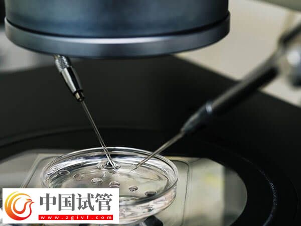綿陽市中心醫院助孕全程開銷匯總，檢查到手術至少3w(圖1)