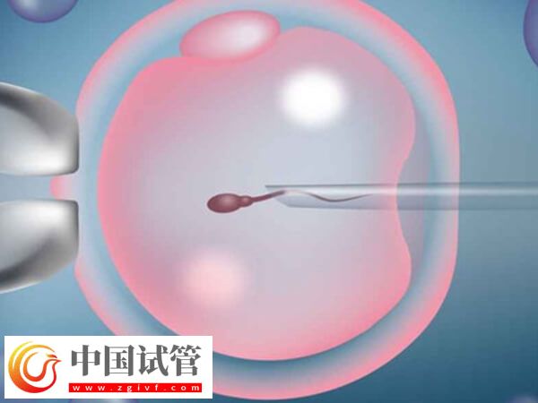 重慶權(quán)威人工授精醫(yī)院排行榜，前三名成功率均能達(dá)到25%(圖2)