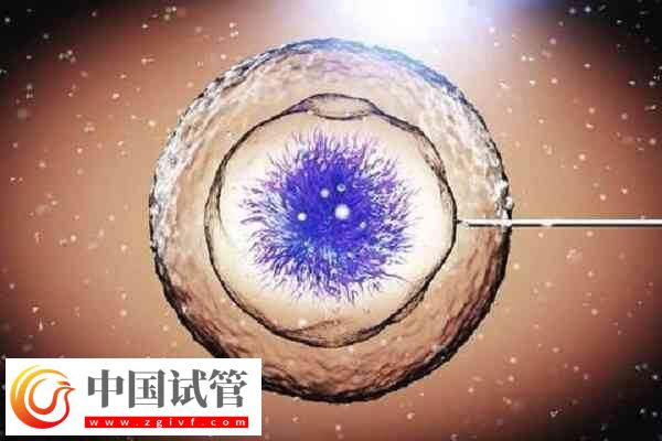 一代試管嬰兒受精失敗精卵不結(jié)合的原因有哪些？(圖1)