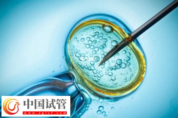 同性戀可不可以做試管嬰兒生龍鳳胎(圖1)