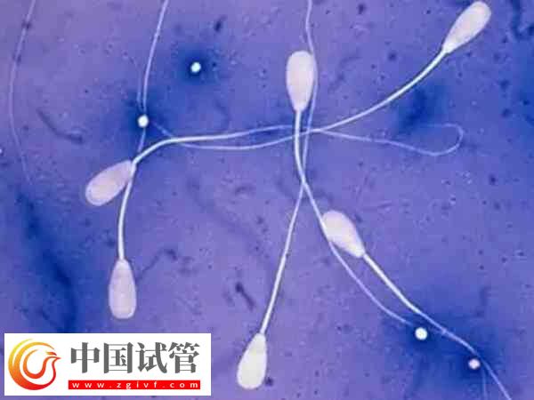 弱精少精是什么原因?qū)е碌?圖1)