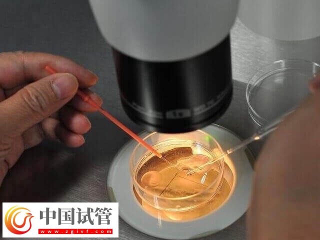 大齡試管嬰兒好孕經(jīng)驗(yàn)有哪些(圖1)