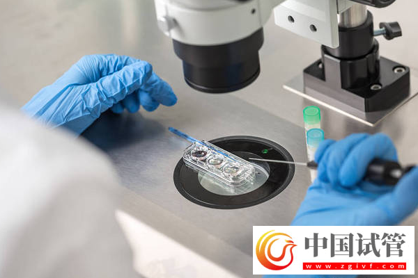 試管嬰兒全攻略：9大常識不可不知！(圖2)