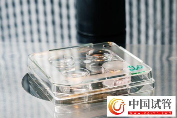 試管嬰兒全攻略：9大常識不可不知！(圖3)