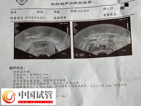 試管移植后一超二超三超時間多久(圖1)