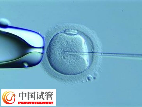 泰國(guó)試管嬰兒能活多久(圖1)