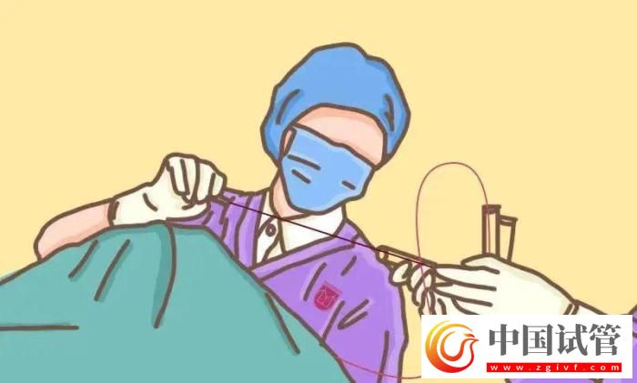 試管嬰兒有哪些出乎意料的概念？(圖4)