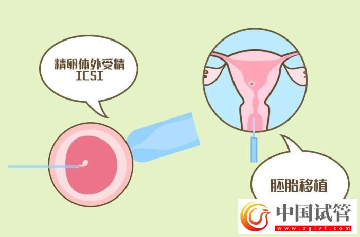 試管嬰兒有哪些出乎意料的概念？(圖6)