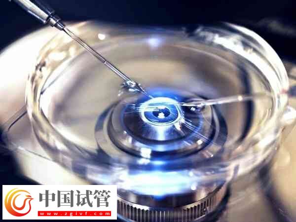 試管一般取多少卵好(圖1)