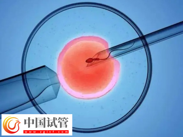 高齡試管有什么風(fēng)險(xiǎn)(圖2)