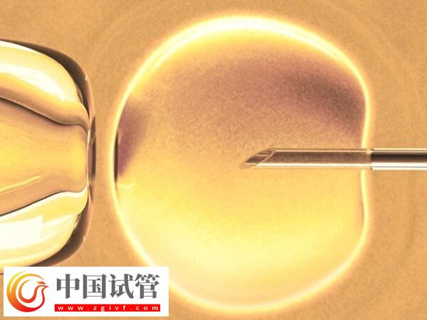 卵泡期長方案適合哪些人(圖1)