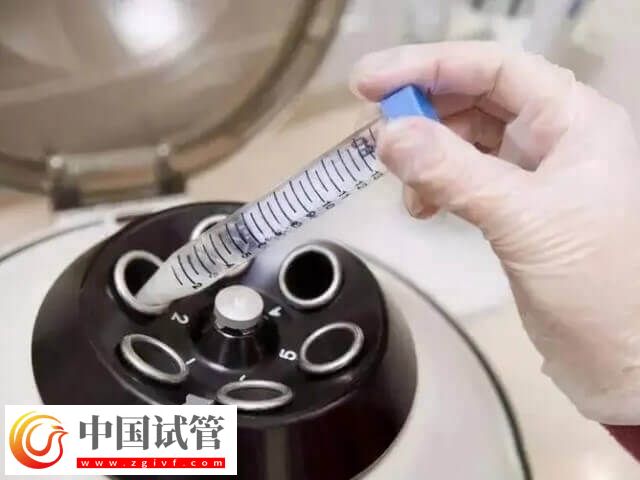 試管睪丸穿刺取精要穿刺幾次(圖2) 試管睪丸穿刺取精要穿刺幾次(圖2)