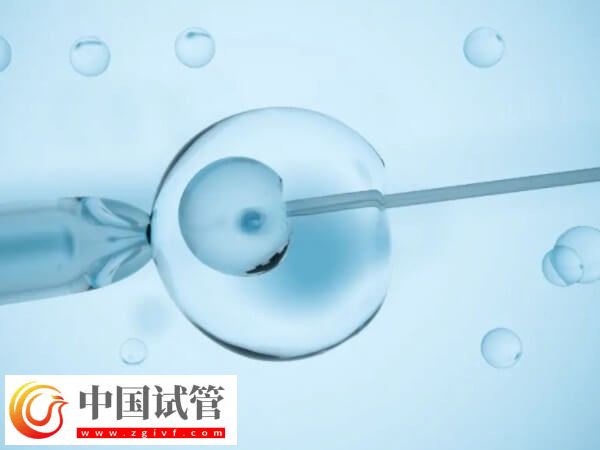 試管睪丸穿刺取精要穿刺幾次(圖1) 試管睪丸穿刺取精要穿刺幾次(圖1)