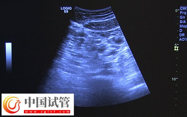 咸寧市中心醫(yī)院監(jiān)測(cè)卵泡多少錢(qián)(圖1)