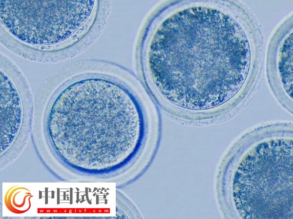 促排6個基礎卵泡能取多少個卵(圖1) 促排6個基礎卵泡能取多少個卵(圖1)
