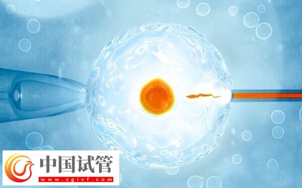 做試管嬰兒為什么要降糖(圖1)