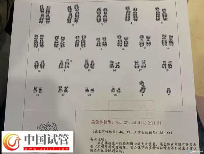 廣州做染色體檢查多少錢？廣東省婦幼保健院約230-3300元左右(圖2)