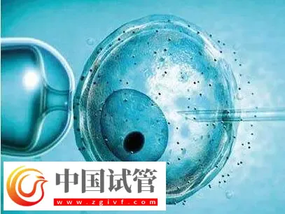 北京做供卵試管不用排隊(duì)的醫(yī)院有哪些？這些公立醫(yī)院紛紛上榜(圖3)