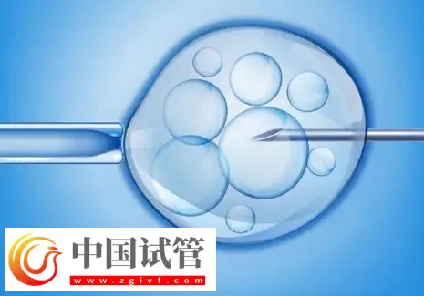 濟南2025試管助孕代/懷產子機構名單，附流程與費用介紹(圖1)