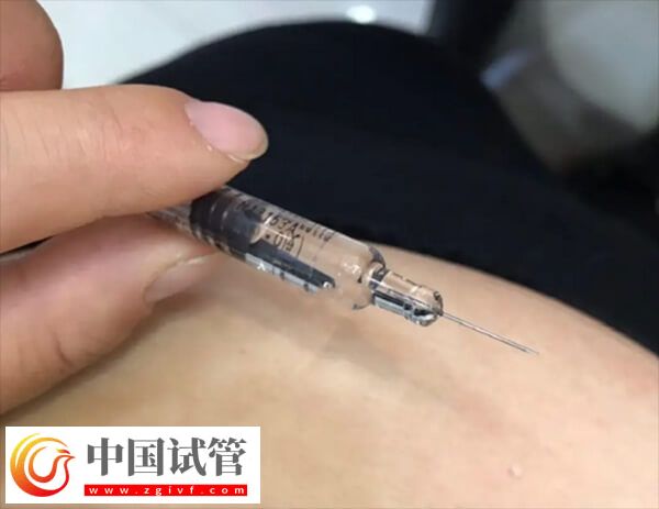 試管嬰兒長方案和短方案哪個好(圖1)
