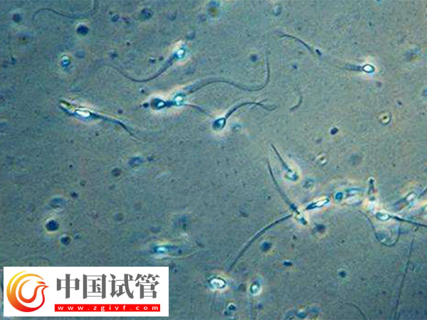 做供精試管可否自行選擇相貌(圖3)