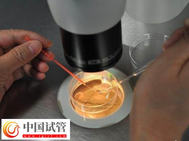 胚胎著床失敗是什么情況(圖1)