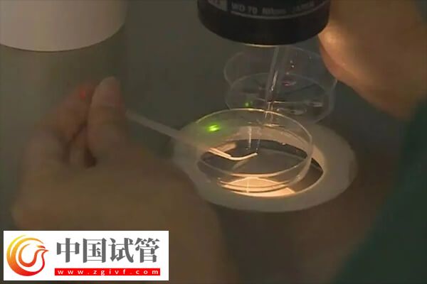 做試管一般取卵幾個(圖2)