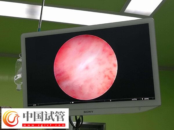 凍胚移植失敗了是不是質(zhì)量不好(圖2)