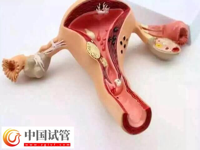 什么會影響試管嬰兒成功率(圖1)