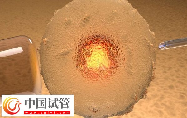 三代試管PGD技術(shù)檢測是否必須養(yǎng)囊(圖2)