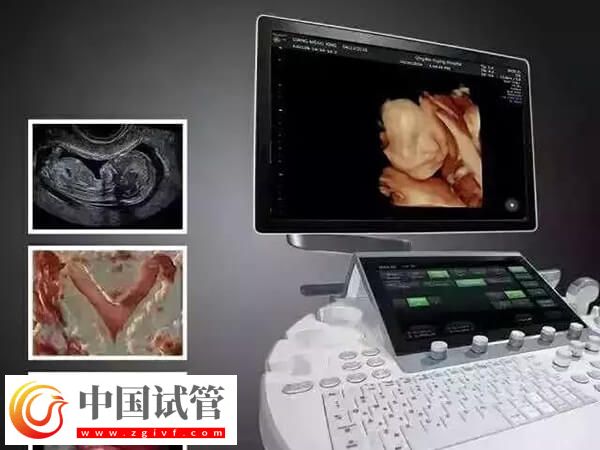 鷹潭公立三甲醫院做一次四維彩超多少錢？(圖1)