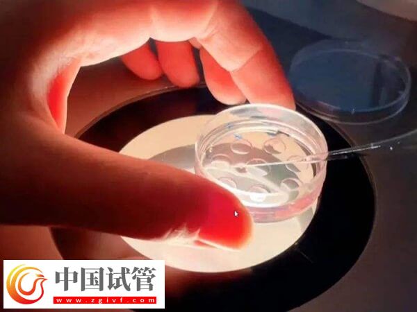 試管可不可以移植兩個胚胎？(圖3)