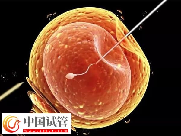 松原能做一代試管的三甲醫(yī)院是哪家？(圖1)