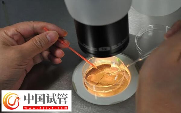 為什么醫(yī)生不給移植鮮胚(圖1)