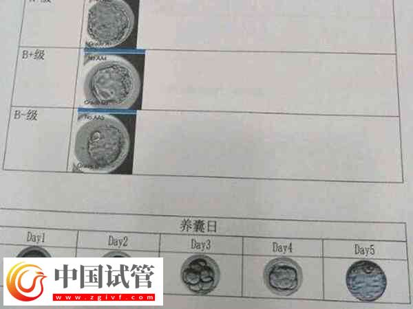 囊胚和凍囊胚是否一樣(圖1)