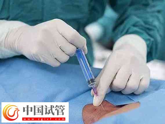 睪丸取精：試管嬰兒的新希望(圖1)