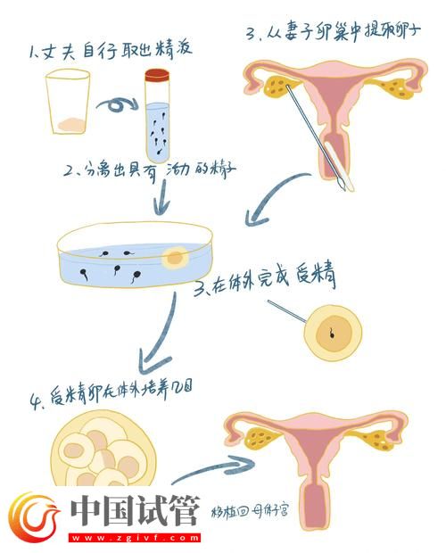 試管嬰兒的孕卵發(fā)育過(guò)程詳解(圖2)