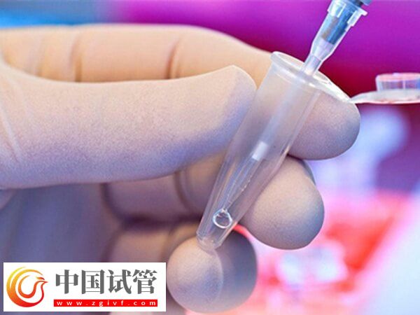 試管嬰兒哪個(gè)步驟最疼(圖3)