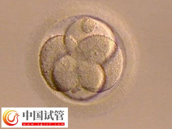 試管嬰兒移植前胚胎如何評分(圖1)