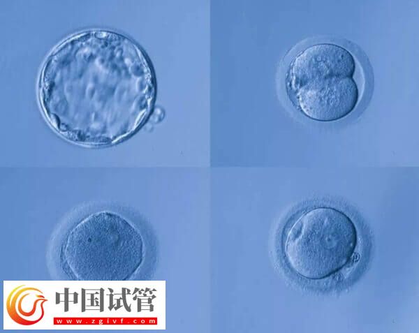 高齡是不是適合養(yǎng)囊胚(圖1)