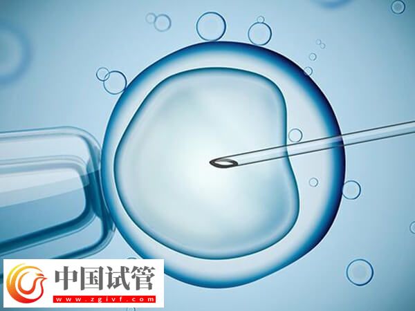 ivf和icsi的區別是什么(圖1)