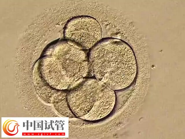 如何改善一卵多精的情況(圖1)