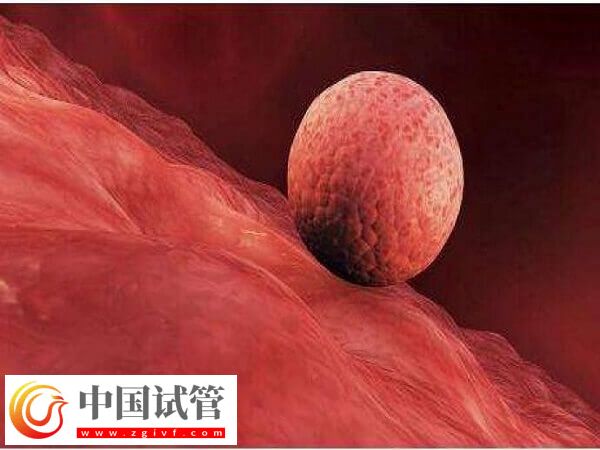 囊胚移植到子宮之后的狀態是直接著床還是先游離？(圖1)