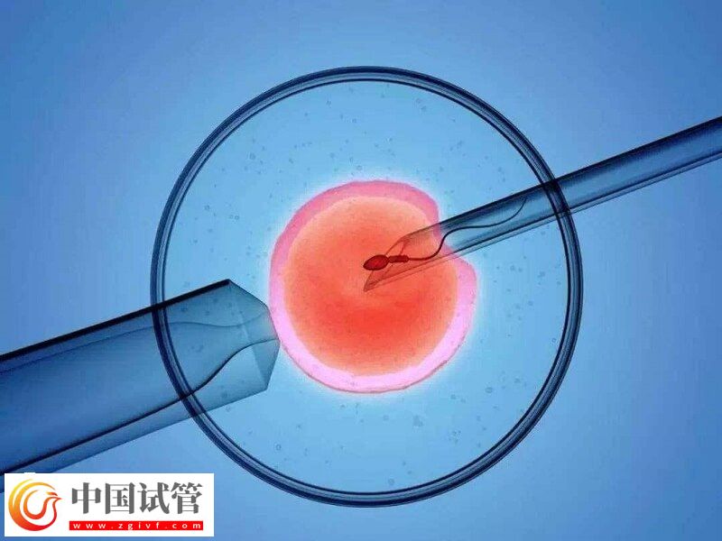 人工授精跟試管嬰兒有什么區別(圖1)