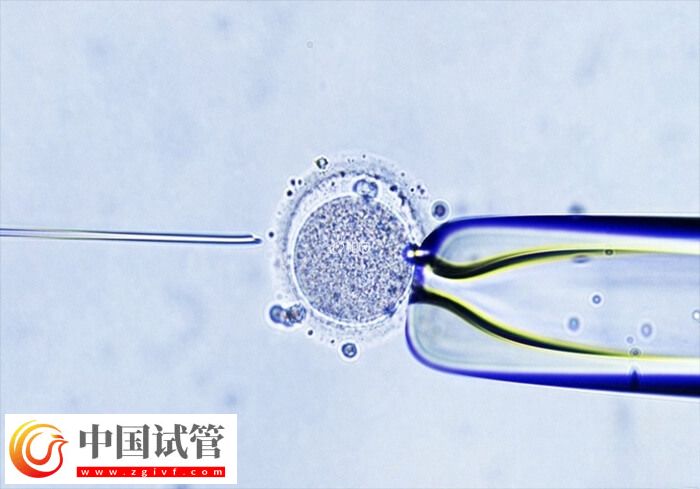 試管嬰兒助孕有幾個(gè)階段(圖1)