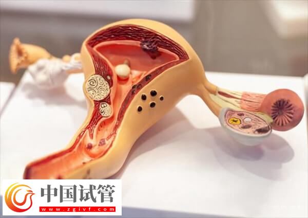 子宮肌瘤女性不能吃的食物有哪些(圖1)