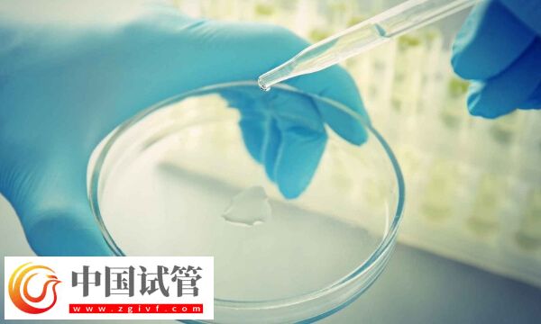 試管嬰兒精液檢查都有什么項目(圖1)