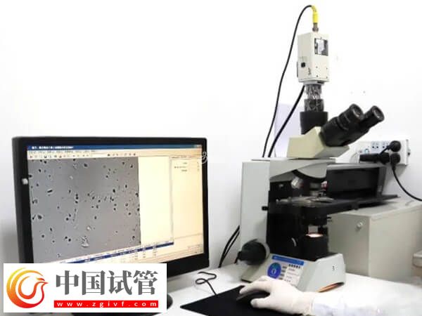 試管嬰兒精液檢查都有什么項目(圖2)